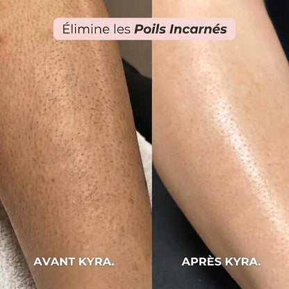 Rasoir 2 en 1 Kyra™ pour le maillot et le corps