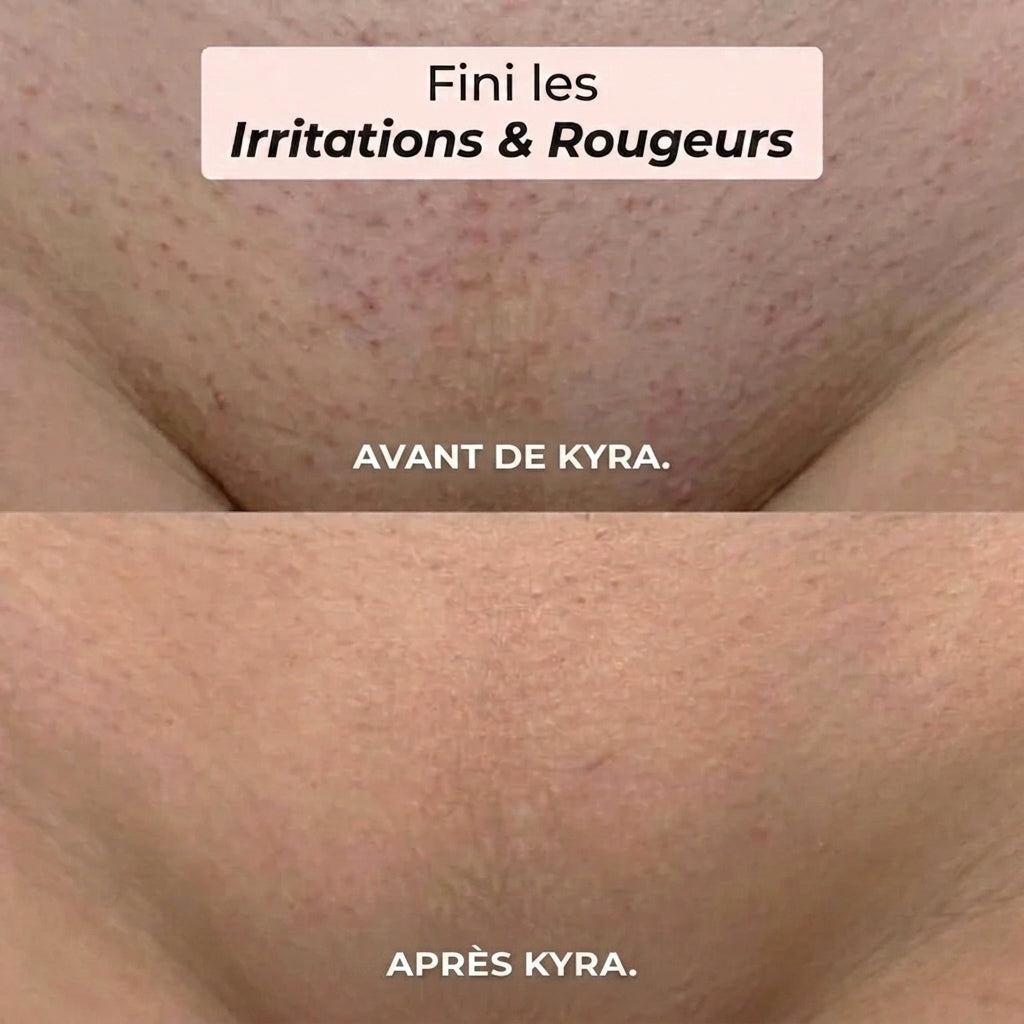 Rasoir 2 en 1 Kyra™ pour le maillot et le corps