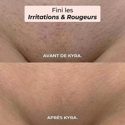 Rasoir 2 en 1 Kyra™ pour le maillot et le corps